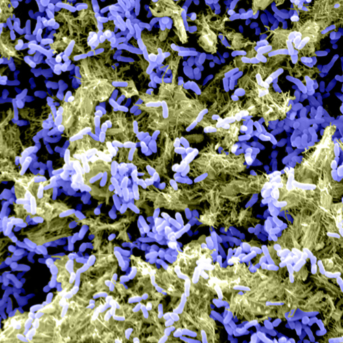 Pseudomonas-aeruginosa-biofilms.jpg