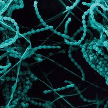 All-Journals-Image-425x500px-Dennis-Kunkel-Microscopy-SPL.jpg